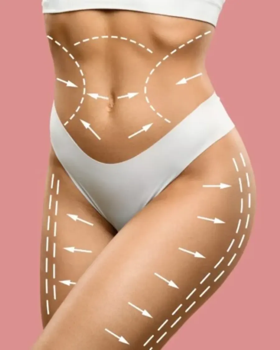Advanced Non-Surgical & Surgical Body Sculpting at Cinch Clinics